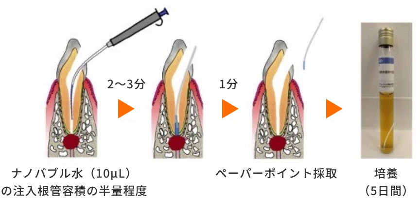 根管内嫌気培養検査